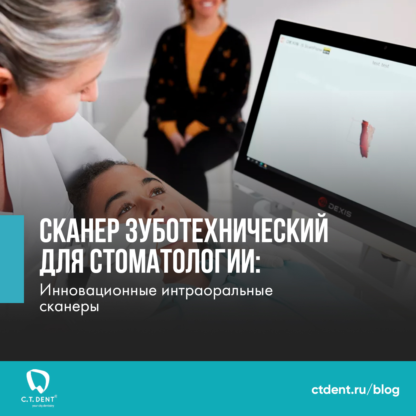 Сканер зуботехнический для стоматологии: инновационные интраоральные сканеры Сканер зуботехнический для стоматологии: инновационные интраоральные сканеры