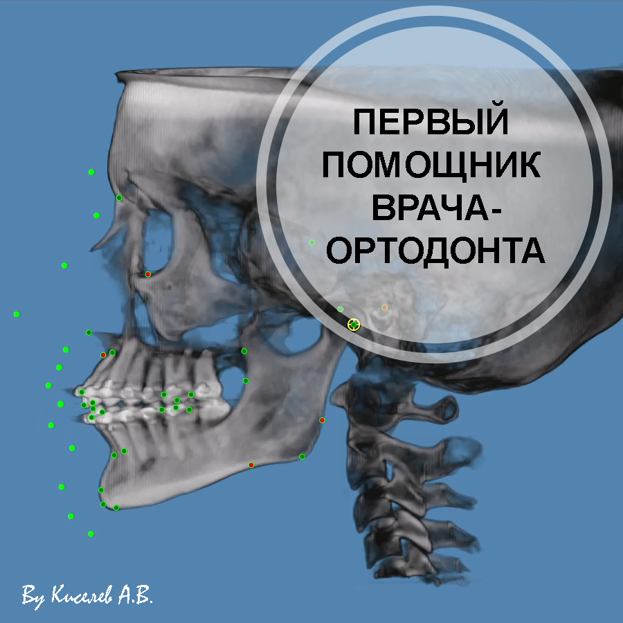 Dolphin® - первый помощник врача-ортодонта | C.T.DENT — стоматологические  материалы и оборудование