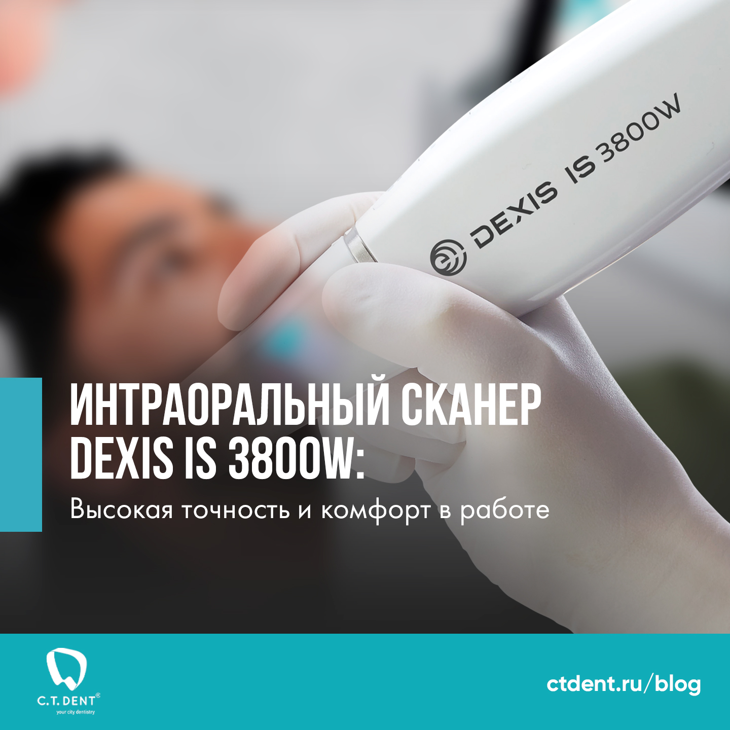 Интраоральный сканер DEXIS IS 3800W: Высокая точность и комфорт в работе Интраоральный сканер DEXIS IS 3800W: Высокая точность и комфорт в работе