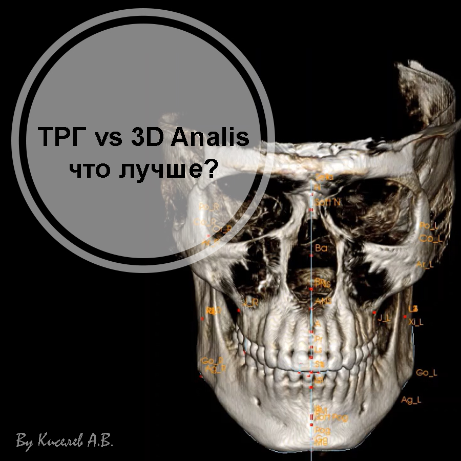 ТРГ vs 3D Analis, что лучше? | C.T.DENT — стоматологические материалы и  оборудование