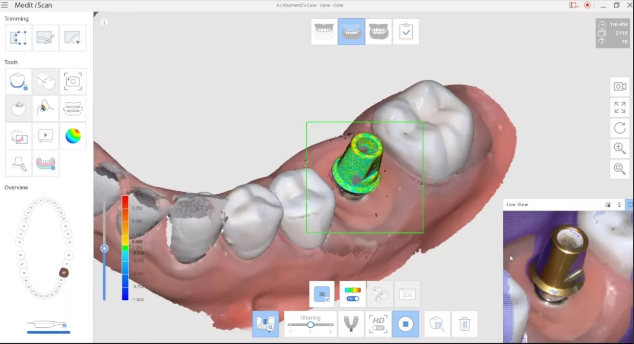 Цифровая стоматология. Обучение работе с 3D сканером MEDIT I700 | C.T.DENT  — стоматологические материалы и оборудование